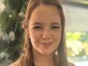 Change in speech led to 18yo being diagnosed with ‘childhood Alzheimer's’