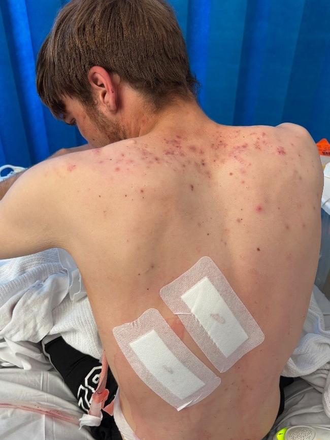 Mr Petzler was attacked by a group of at least 10 teenage thugs. Picture: Supplied