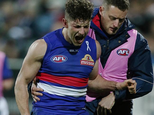 AFL Round 19 : Geelong v Western Bulldogs Tom Liberatore injured Picture:Wayne Ludbey