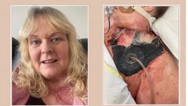 The Ballarat community is rallying around grief counsellor Carolyn Gower as she recovers from a flesh-eating bacteria infection. Picture: GoFundMe