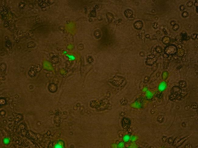 Mosquito cells infected with Ross River Virus that is green fluorescent.