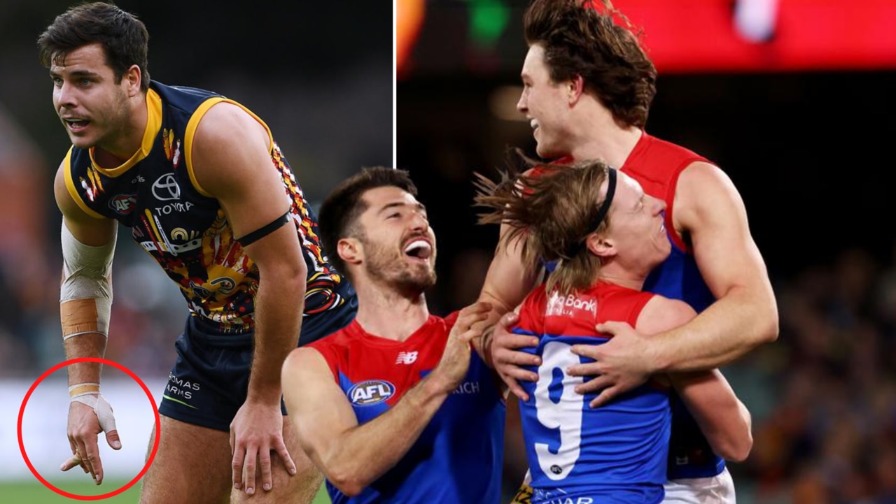 Melbourne has celebrated, despite a plucky effort from the Crows – and a crook finger injury to Darcy Fogarty.