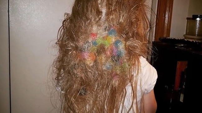 This mom spent 20 hours removing 150 'Bunchems' toys from her daughter's  hair