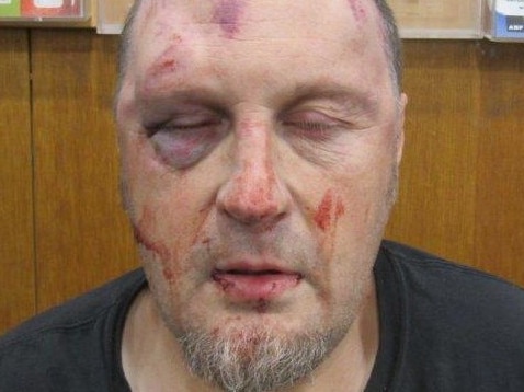 Police say the 50-year-old was left 'traumatised and severely injured'. Picture: Victoria Police.