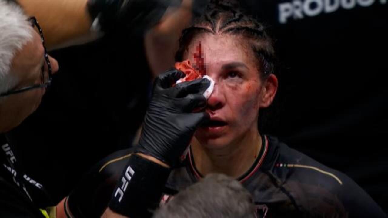 GRAPHIC: Aldana suffers BRUTAL gash