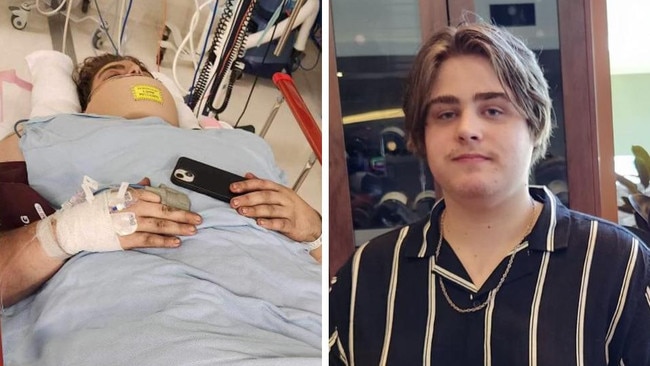 Blacks Beach teen Ethan Desborough was seriously injured with heavy steel beams fell on his back in a workplace incident at Paget. Picture: Supplied by Desborough family