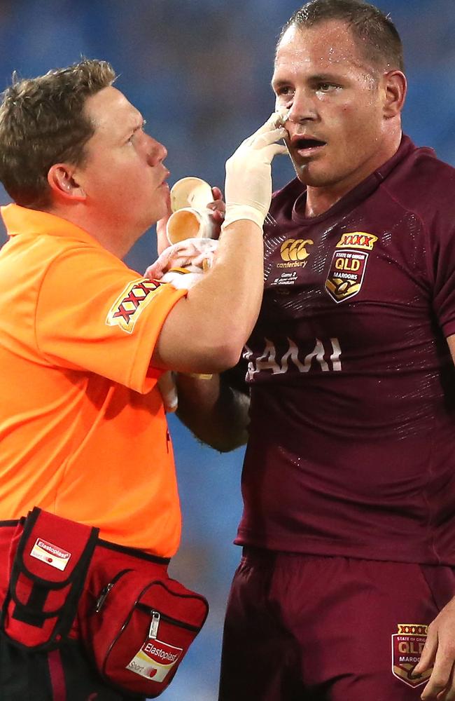 Matt Scott receives treatment on his fractured cheekbone during game two.