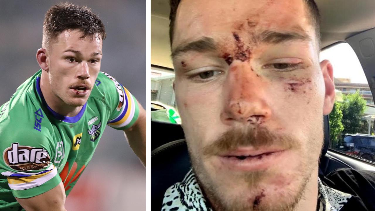 Charges relating to assaulting police against Tom Starling have been dropped.