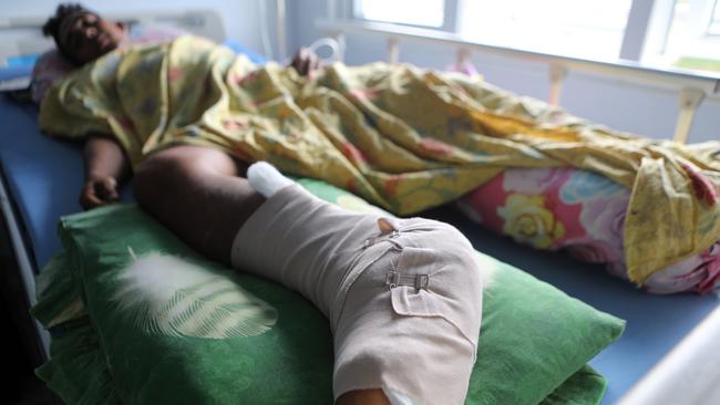 Edi Ron at Meuraxa General Hospital, Banda Aceh. Picture: Gomos Simanjuntak