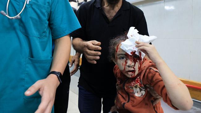 An injured girl holds a handkerchief to her head at the Al-Nasr a hospital, following Israeli bombardment in the southern Gaza Strip. Picture: AFP