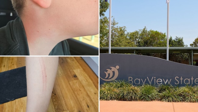 Alleged bullying at Bay View State School. Picture: Supplied