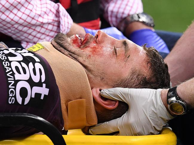 Corey Oates was taken from the field in a neck brace.