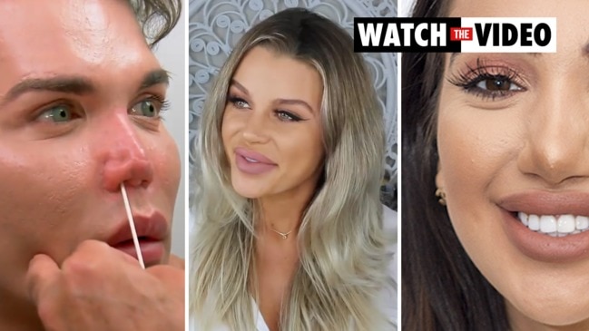 Disfigured Girls Sex Videos - Beauty queen claims she was 'disfigured' by face lift, eyelid  blepharoplasty | news.com.au â€” Australia's leading news site