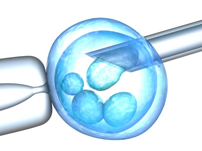 Generic photo illustrating IVF. Picture: iStock