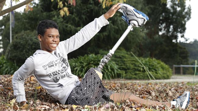 Xavier Mahavelo shows off his new prosthetic leg. Picture: Alex Coppel.