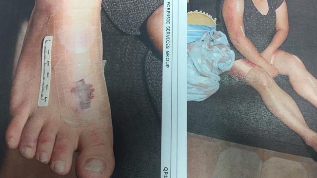 Ms Vann’s injuries. Pic: Supplied. 