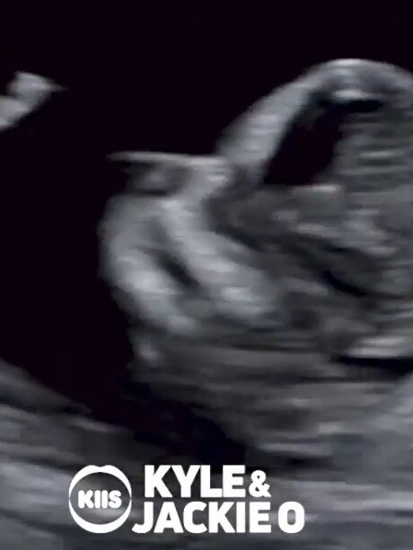 Kyle Sandilands and Tegan Kynaston have shared their ultrasounds pictures. Picture: Instagram