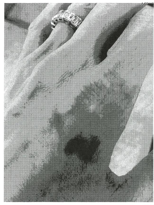 Photos from FBI report allegedly shows injuries on Angelina Jolie's hand. Picture: FBI Doc/NY Post