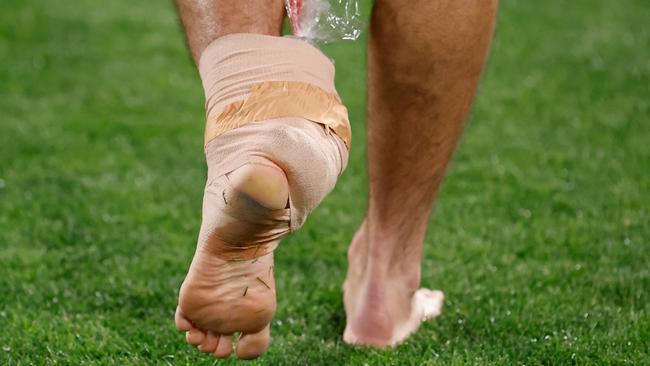 McDonald and his injured ankle were unable to see out the game. (Photo by Dylan Burns/AFL Photos via Getty Images)