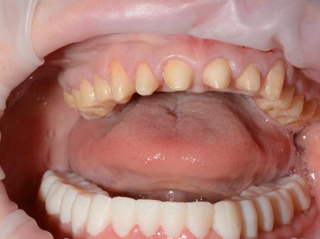 The comparison between Ms Edwards' teeth. Picture: Supplied