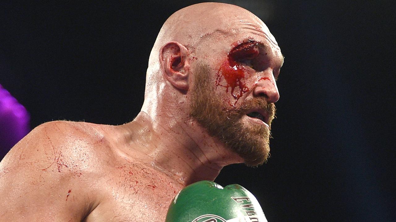 Tyson Fury is set to face Anthony Joshua but there are some hurdles. (Photo by David Becker/Getty Images)