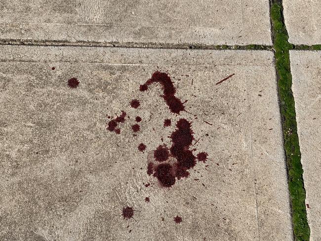 Blood stains on the Esplanade from the stabbing at Semaphore last night. Pics: PAULA THOMPSON