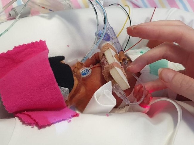 Born at 24 weeks in February and weighing just 475 grams, Skylah Austin is one of the smallest babies to survive. Picture: Supplied