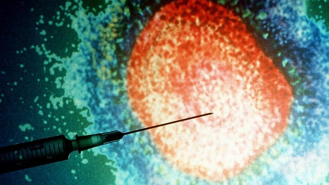 Measles generic.  Picture: Getty