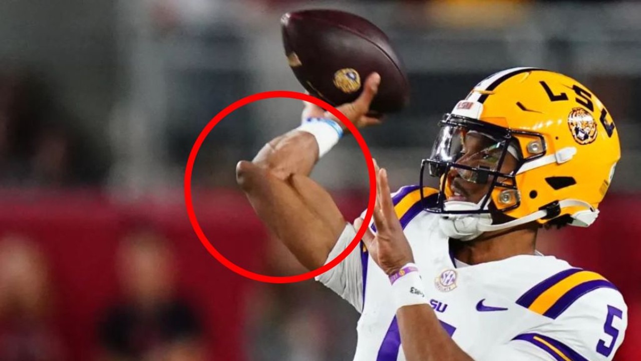 American quarterback’s elbow photo breaks internet