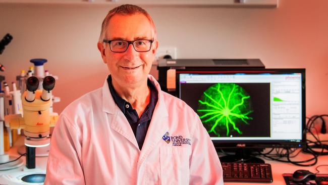 Associate Professor Nigel Barnett sitting next to a scan of the retina. Picture: Supplied