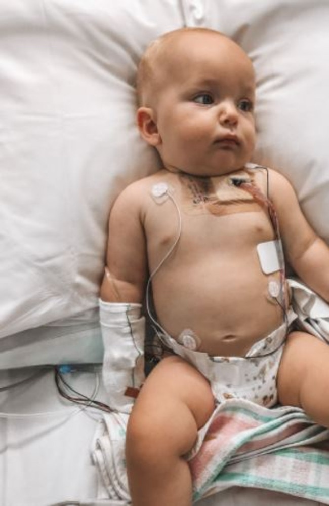 In 2019, Anakin Stimson was born with a complex form of congenital heart disease (CHD) where his heart’s right side aortic arch and left subclavian artery had not developed properly. Photo: contributed.