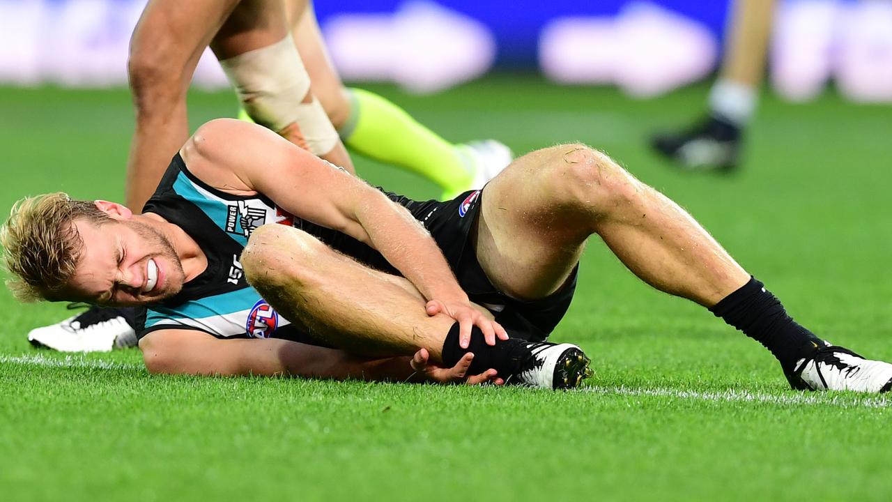 Jack Watts holds his ankle after suffering the injuries against Carlton. Picture: Getty