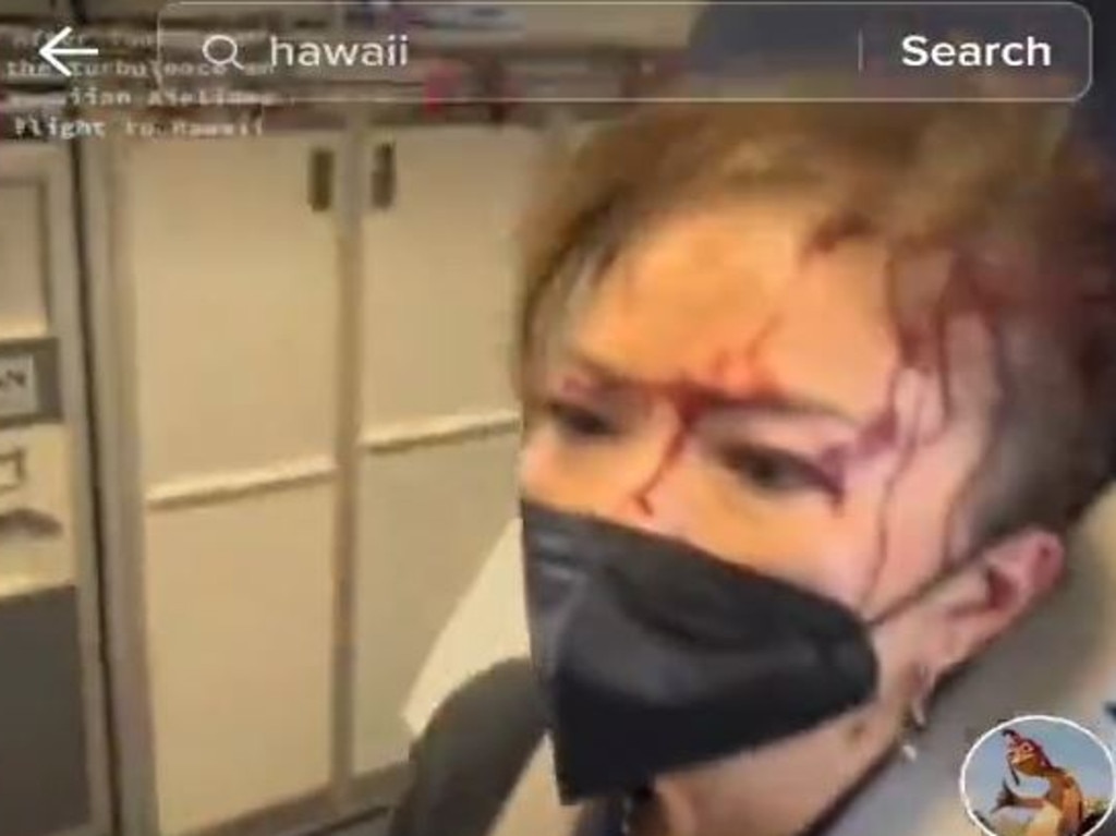 Passengers and flight attendants were injured. Picture: Twitter