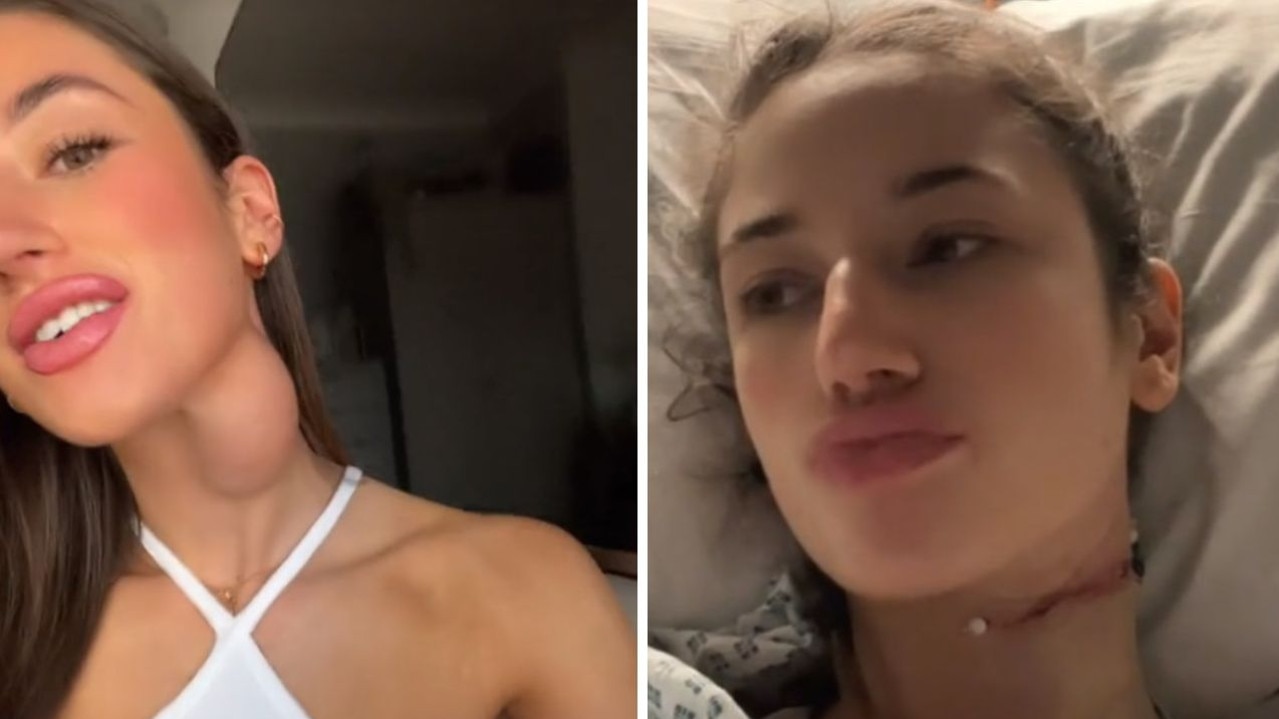 Woman’s TikTok warning after massive lump grows on neck