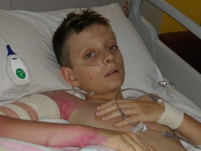 SUNDAY TELEGRAPH SPECIAL, MUST CONTACT ST PIC ED JEFF DARMANIN BEFORE PUBLISHING. , Ivan  Kovalevskiy, 12 year old from Milton recovers in hospital after new years eve fires threatened him home and he was crushed by a falling tree. Ivan seen recovering in hosital . Picture supplied.