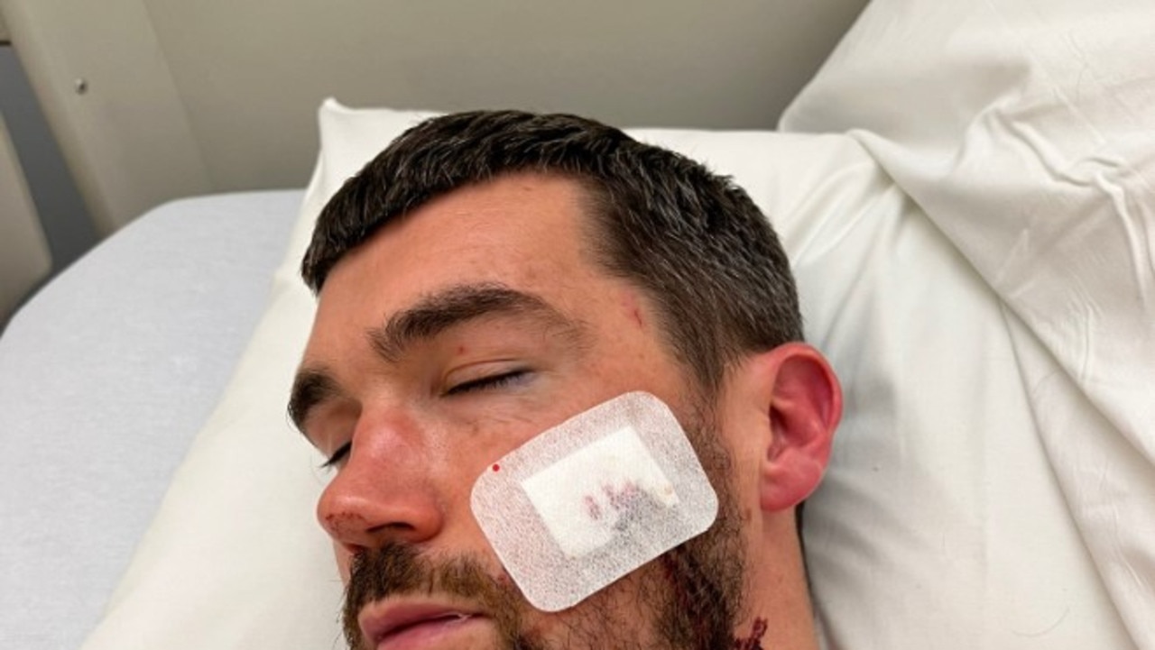 Socceroos captain Mat Ryan injury. Pic: X