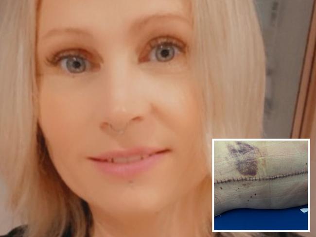 Mum paralysed after horror cliff fall