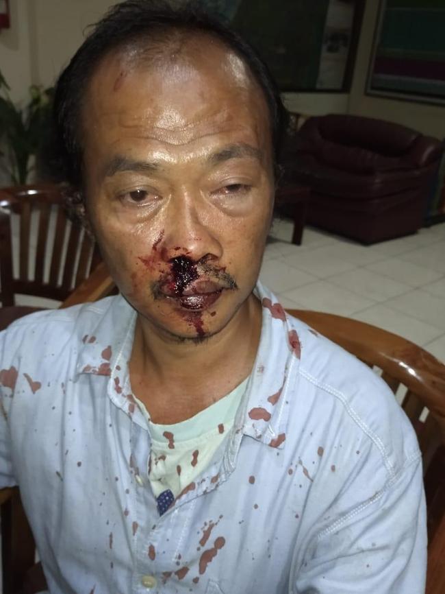 Taxi driver Saiful Nurokhim, 43, was allegedly injured in the attack. Picture: Supplied