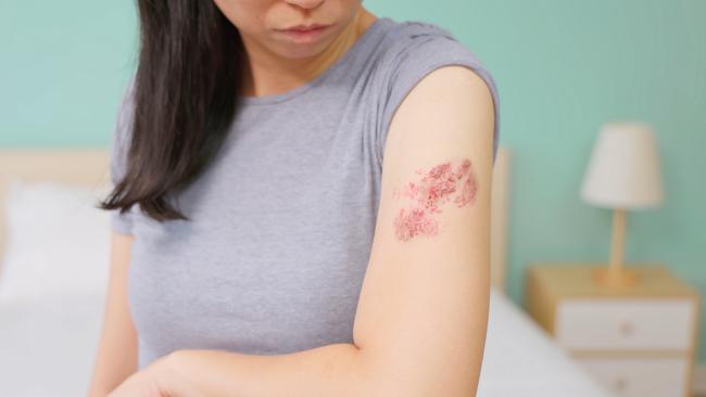 Users of popular drugs Ozempic, Mounjaro and Wegovy have been urged to remain “alert” and report side-effects amid a rise in complaints of shingles.