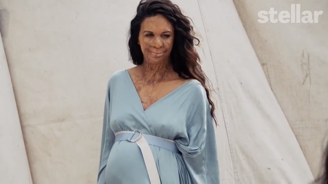 Stellar: Turia Pitt February 2020