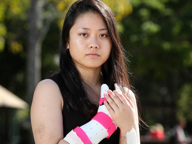 Sara Okazaki, 25 of East Brisbane was attacked and stabbed while walking on Vulture Street. Photographer: Liam Kidston.