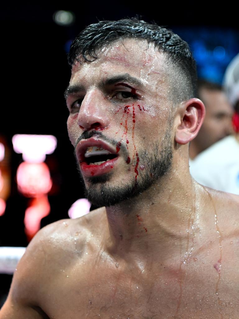 Both fighters were left bloodied and bruised. Picture: Scott Davis / Ace Boxing