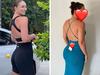 Mum-of-four’s plastic surgery warning