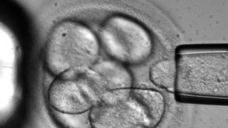 A single cell is removed from a human embryo to be used in generating embryonic stem cells for scientific research. Picture: AP