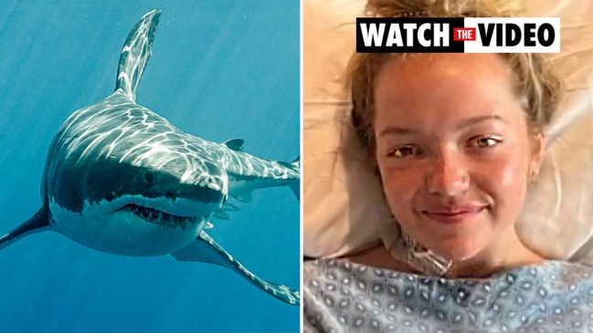 Florida teen who lost leg in shark attack tried to fight off predator