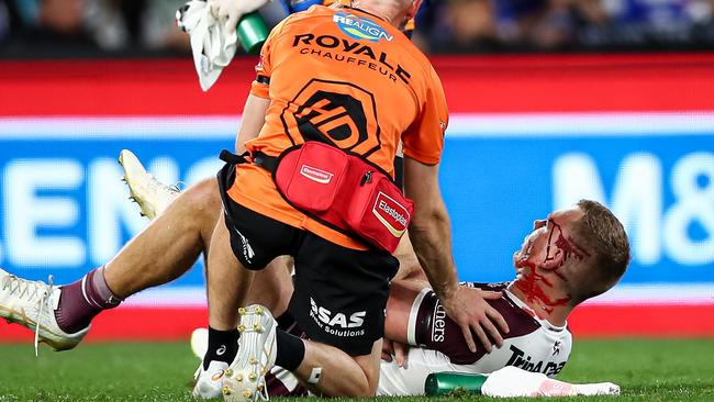 There were fears Tom Trbojevic had done serious damage to his shoulder on Friday night. Picture: NRL Photos