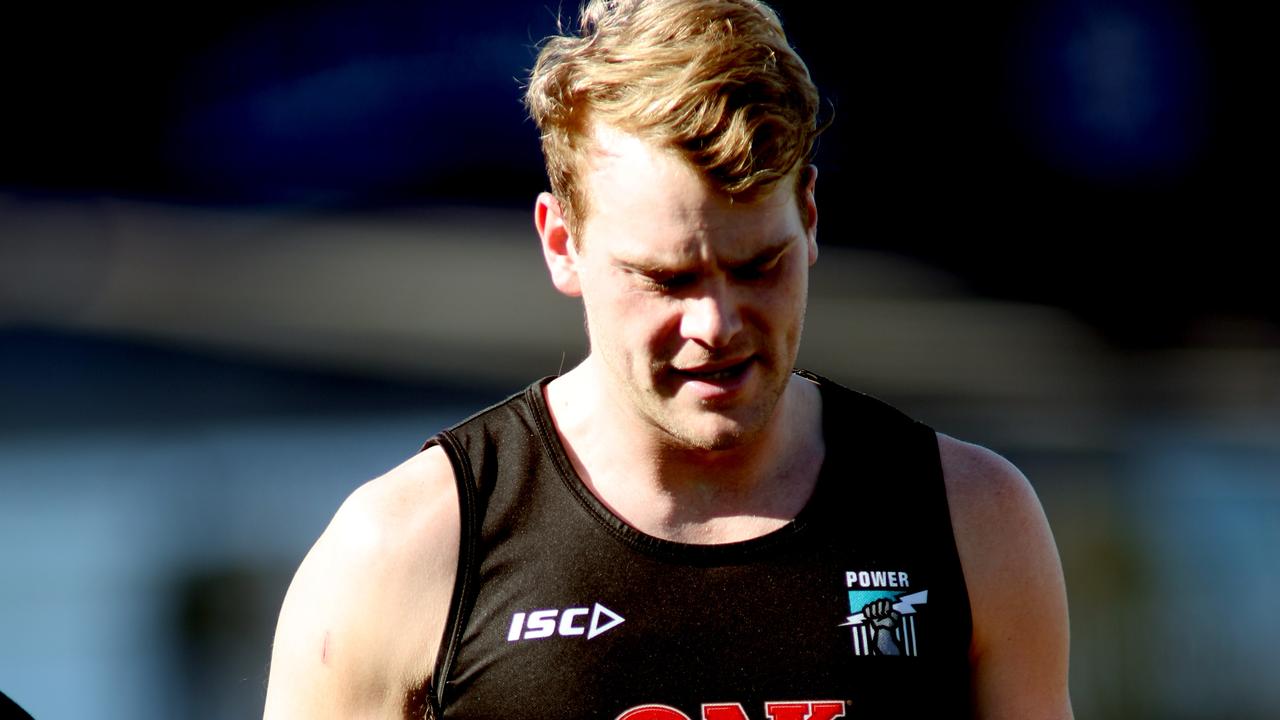 Jack watts battled through some dark times with the support of his family and friends. Picture: AAP Image/Kelly Barnes