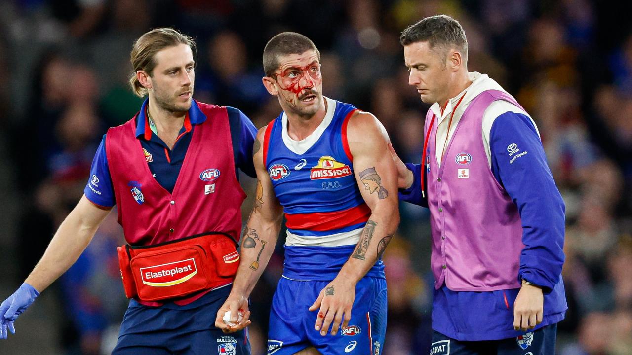 Tom Liberatore suffered another concussion last weekend. Picture: Dylan Burns/AFL Photos via Getty Images
