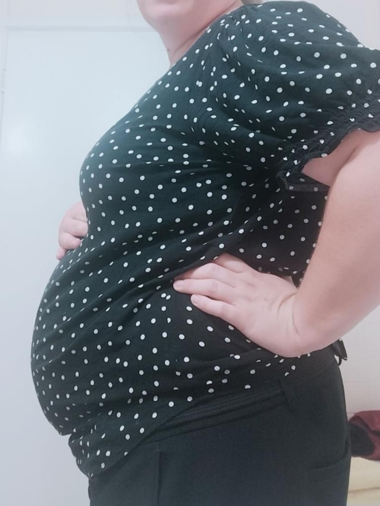 Natasha Van Eck said she looked 24 weeks pregnant prior to doctors removing the fibroid. Picture: Supplied