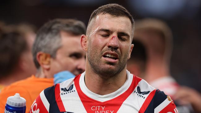 James Tedesco returns from concussion this week. Picture: Getty